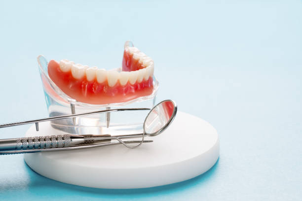 Full Mouth Reconstruction in Monarch Mill, SC